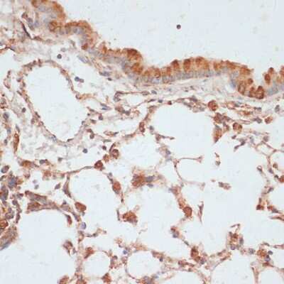Immunohistochemistry-Paraffin: VASP [p Ser157] Antibody - Azide and BSA Free [NBP3-05448]